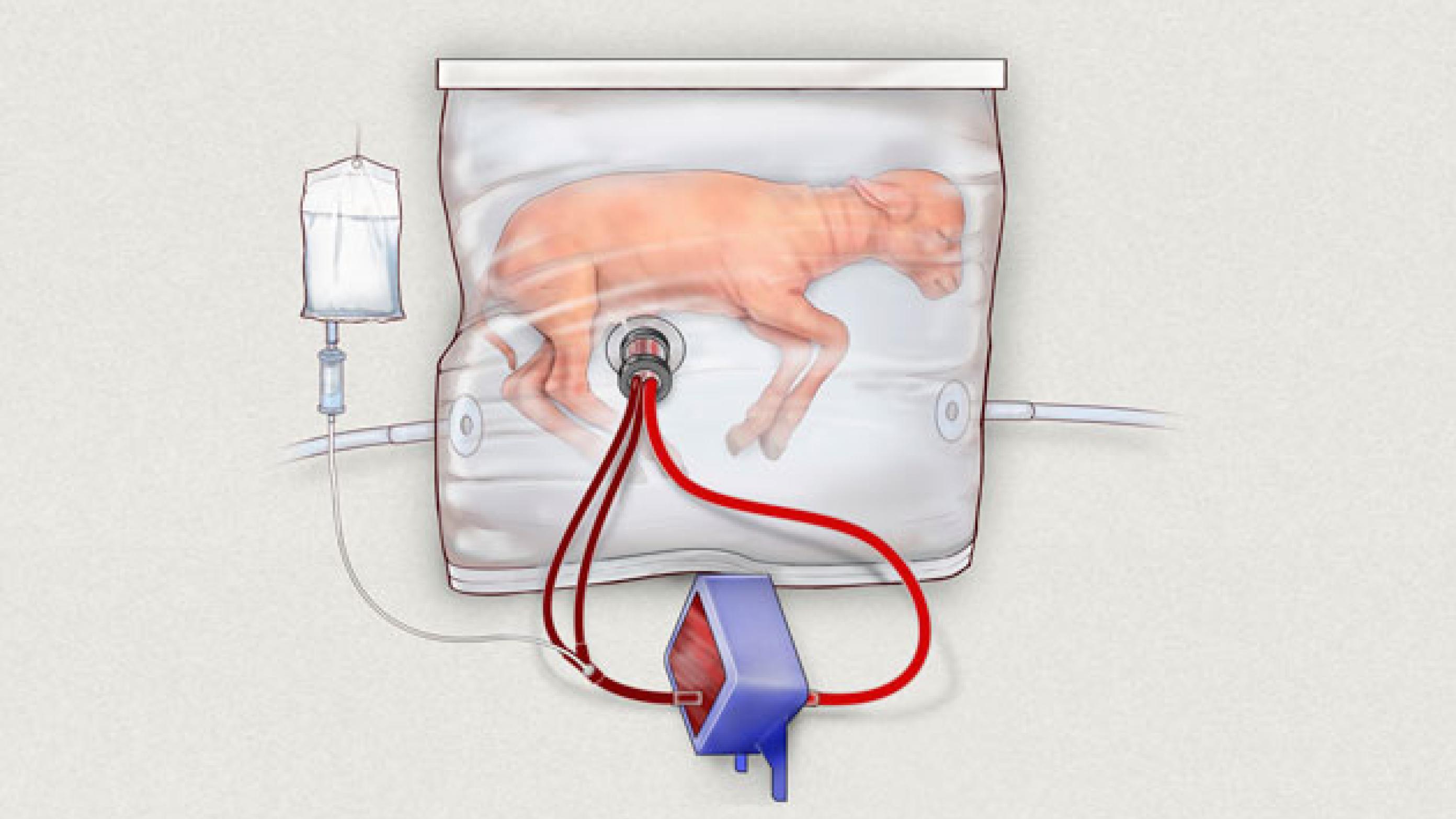 Amerikanske forskere fra Childrens Hospital of Philidelphia lavede for tre år siden en kunstig livmoder som blev testet på lam. Illustration: AP/Ritzau Scanpix