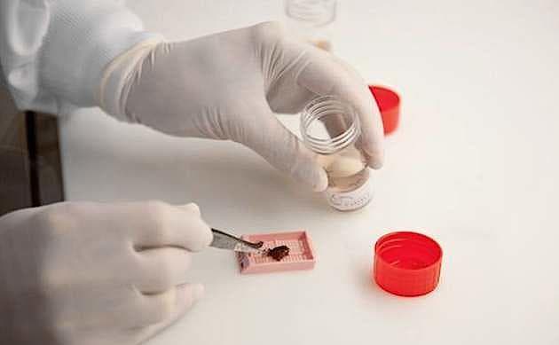 Jo bedre, biobankerne bliver dækket med materiale fra hele Danmark, jo bedre chancer er der for, at det vil komme patienterne til gode. Foto: Integrated BioBank of Luxembourg