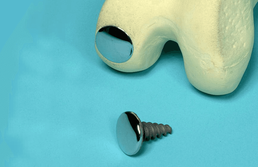 Hemicap er en knappeformet protese, som bores ind i lårknoglen ved et langt mindre indgreb end de store knæoperationer. Foto: Jens Ole Laursen.