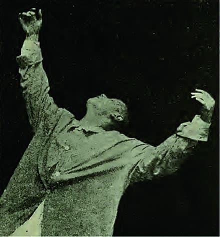 Katatoni. Foto: Emil Kraepelin. (http://imgbuddy.com/catatonic- schizophrenia- waxy-flexibility.asp)