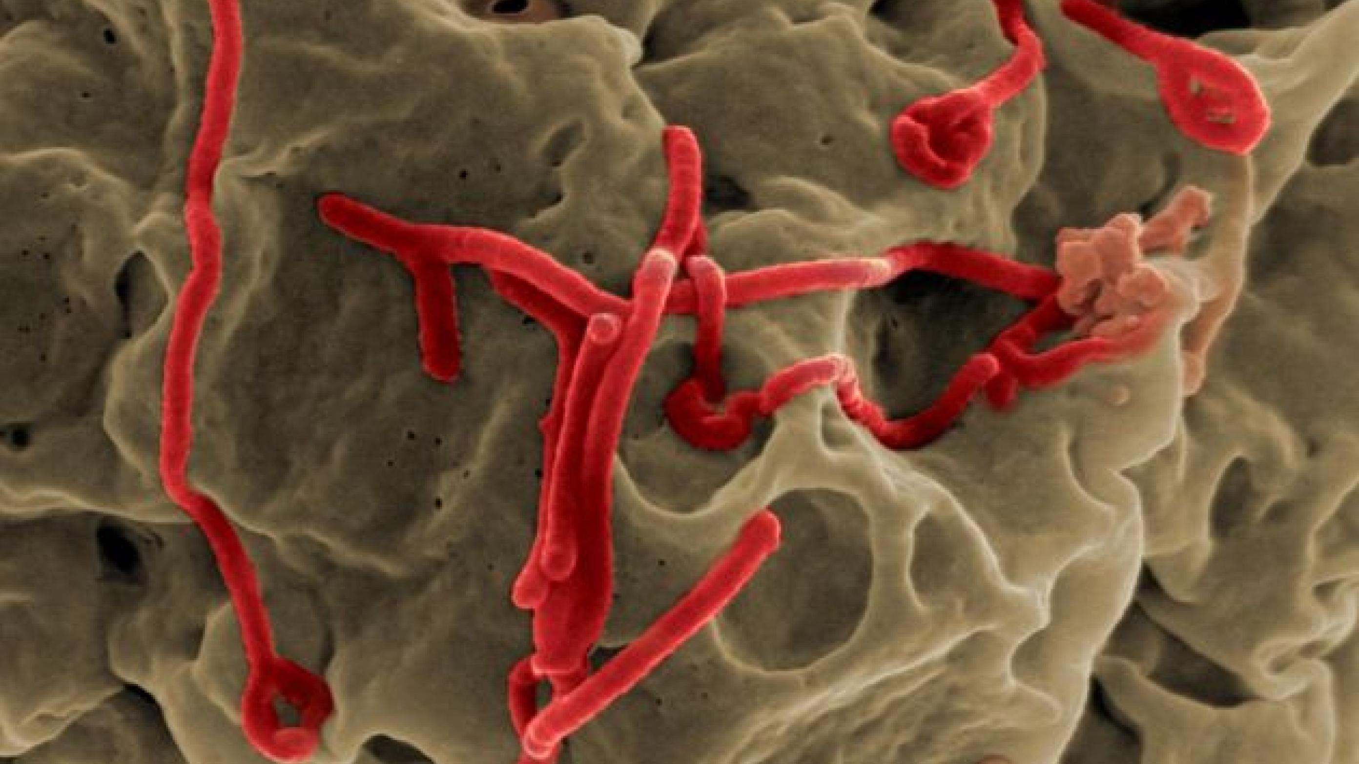 Ebolavirus på celle, set under elektronmikroskop. (Wikimedia Commons)