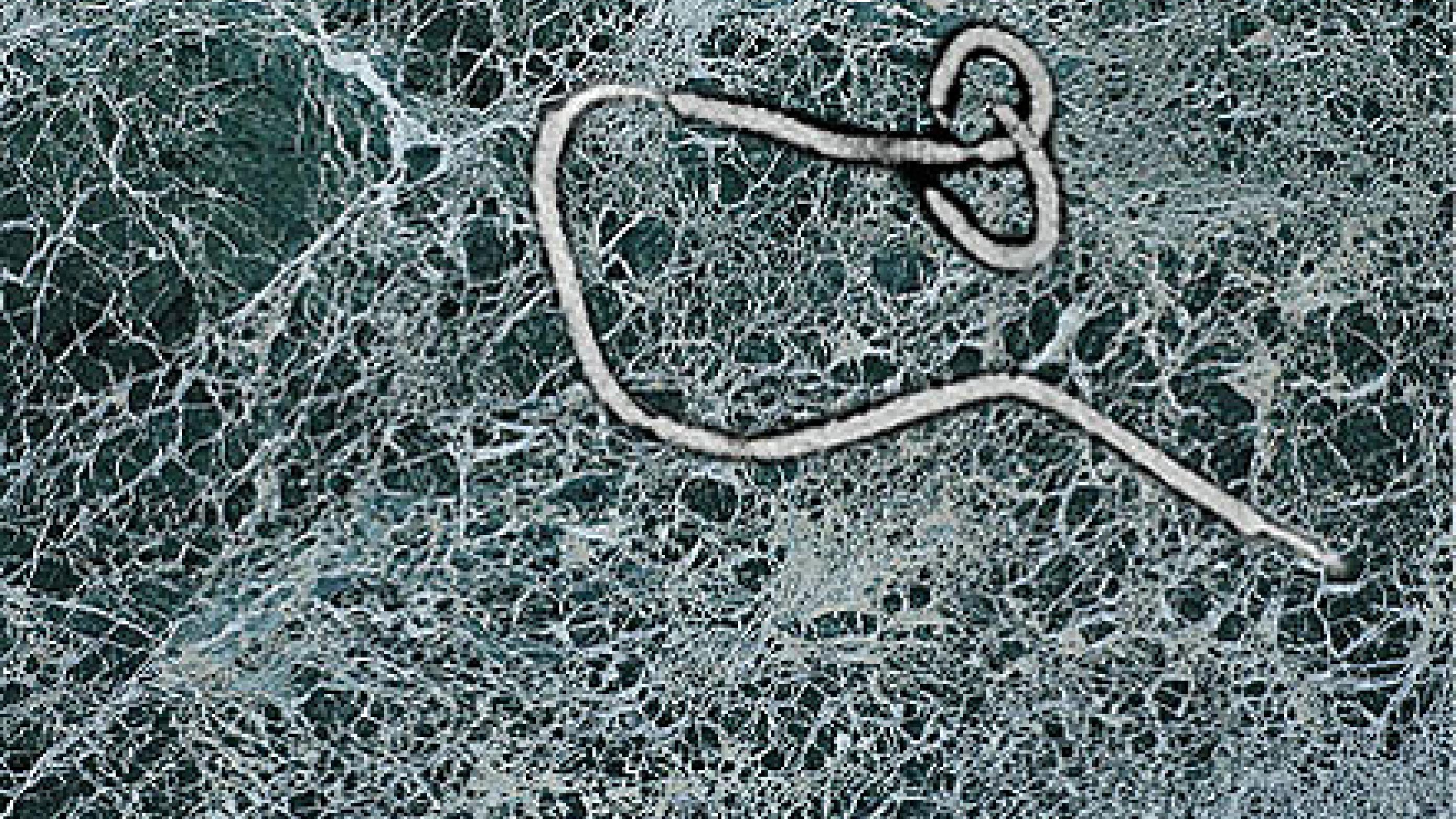 Mikroskopifoto af Ebolavirus.