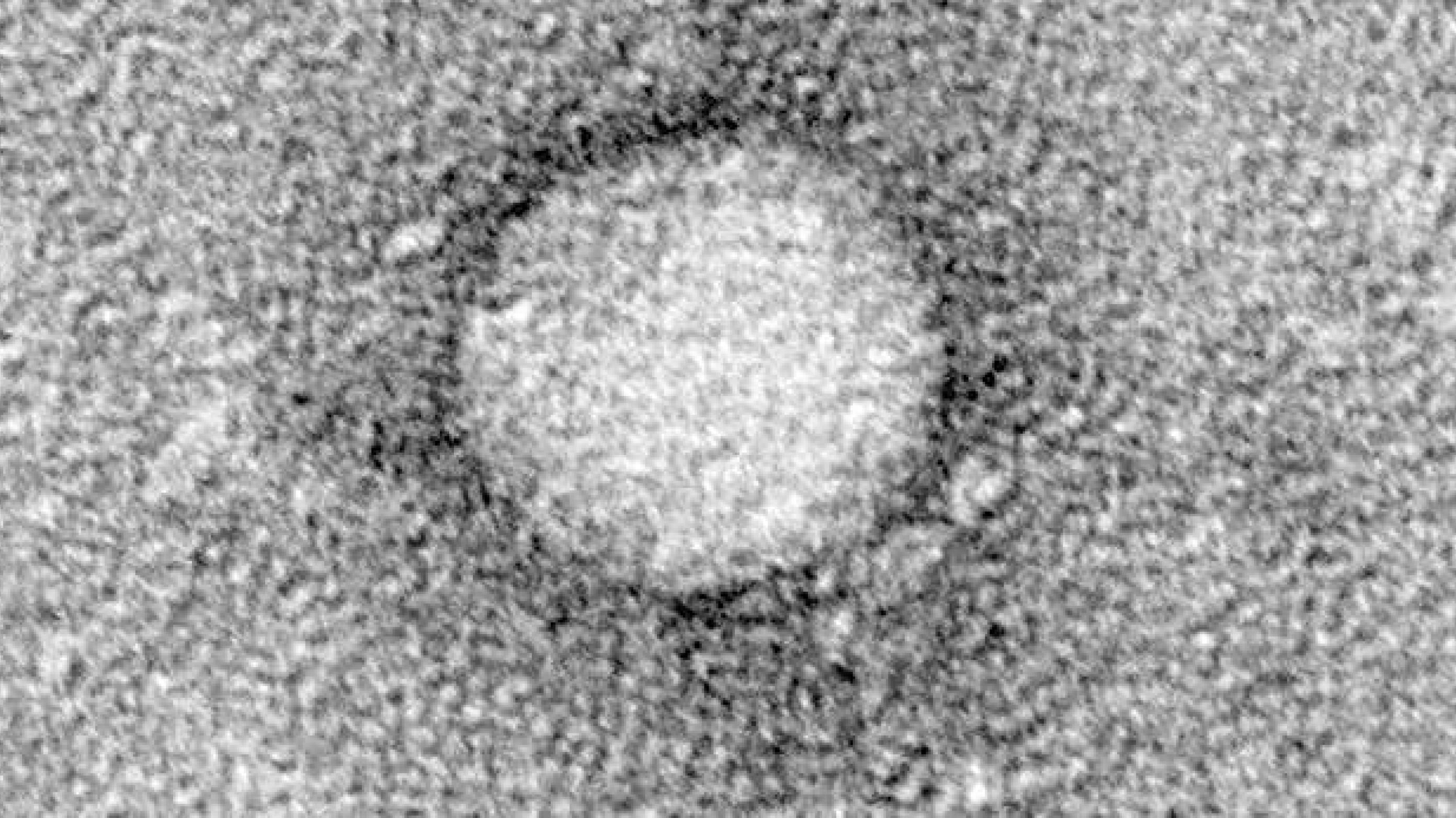 Hepatitis C-virus - også årsag til hoved-hals-kræft? Foto: Wikimedia
