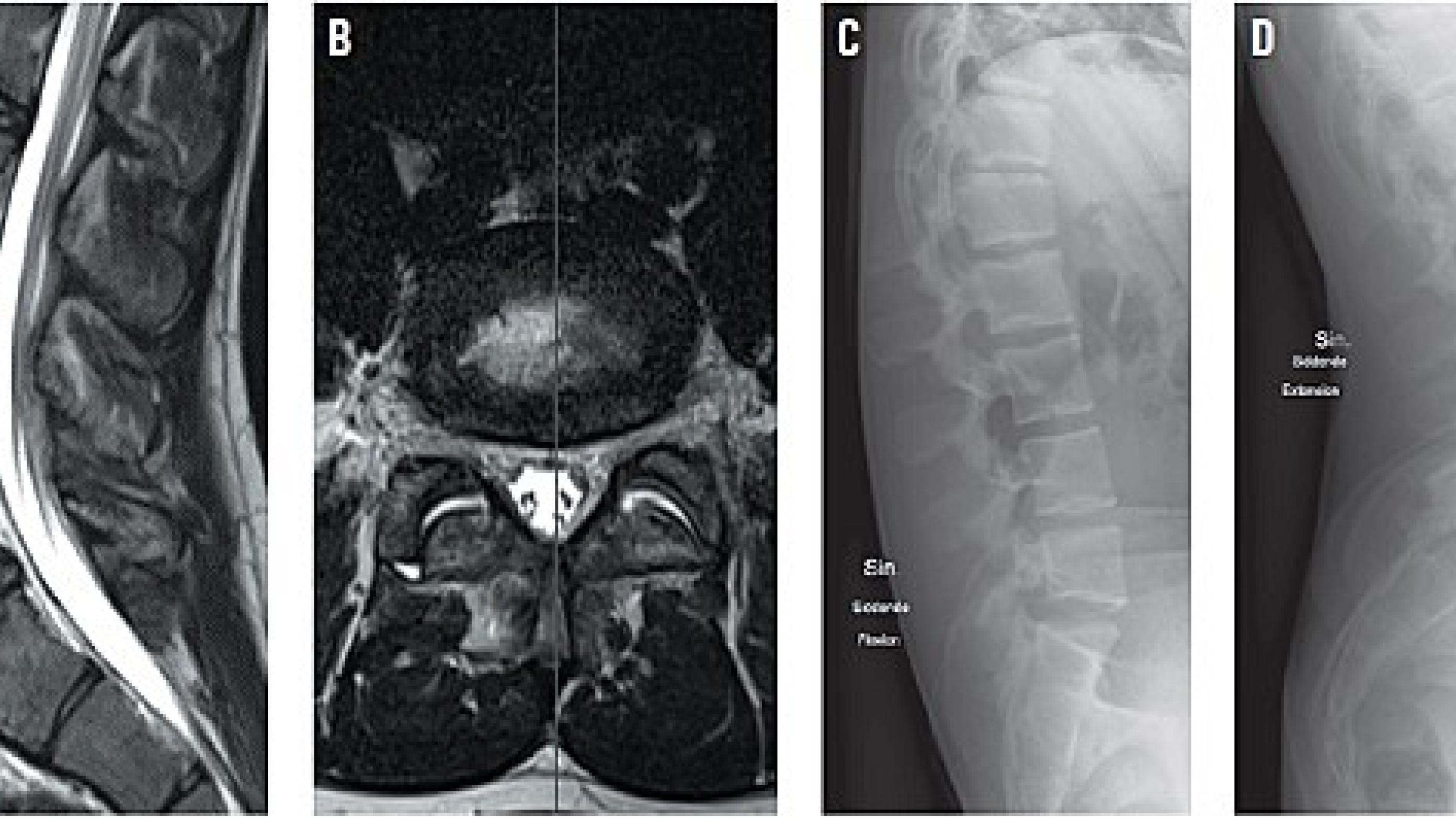 Patient med uspecifikke lænde-ryg-smerter. Copyright: Ugeskrift for Læger