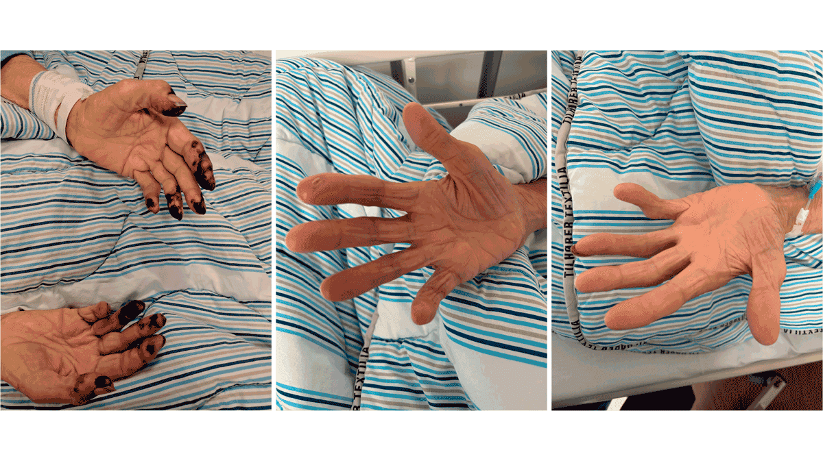 ub