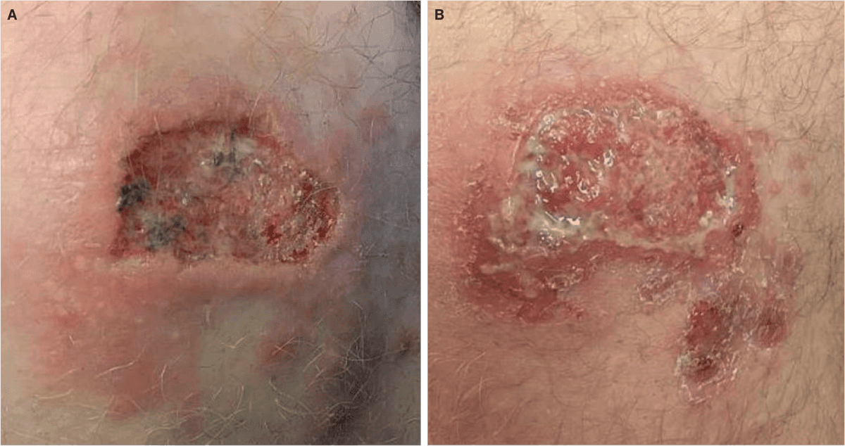 Fotos bringes med patientens tilladelse.