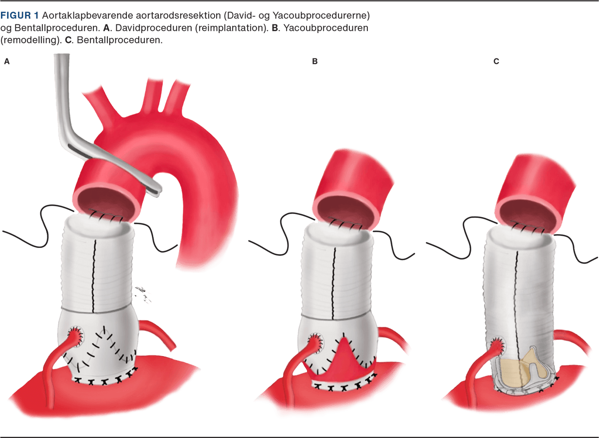 Illustration: Lytfi Krasniqi