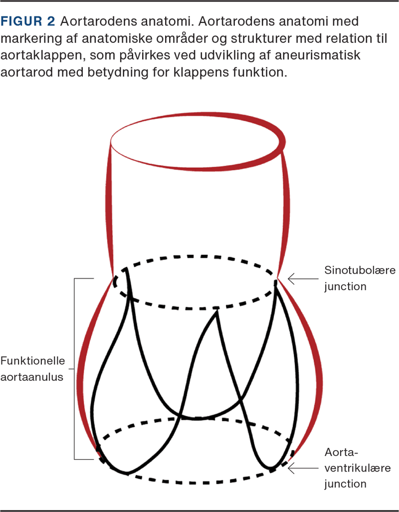 Illustration: Lytfi Krasniqi