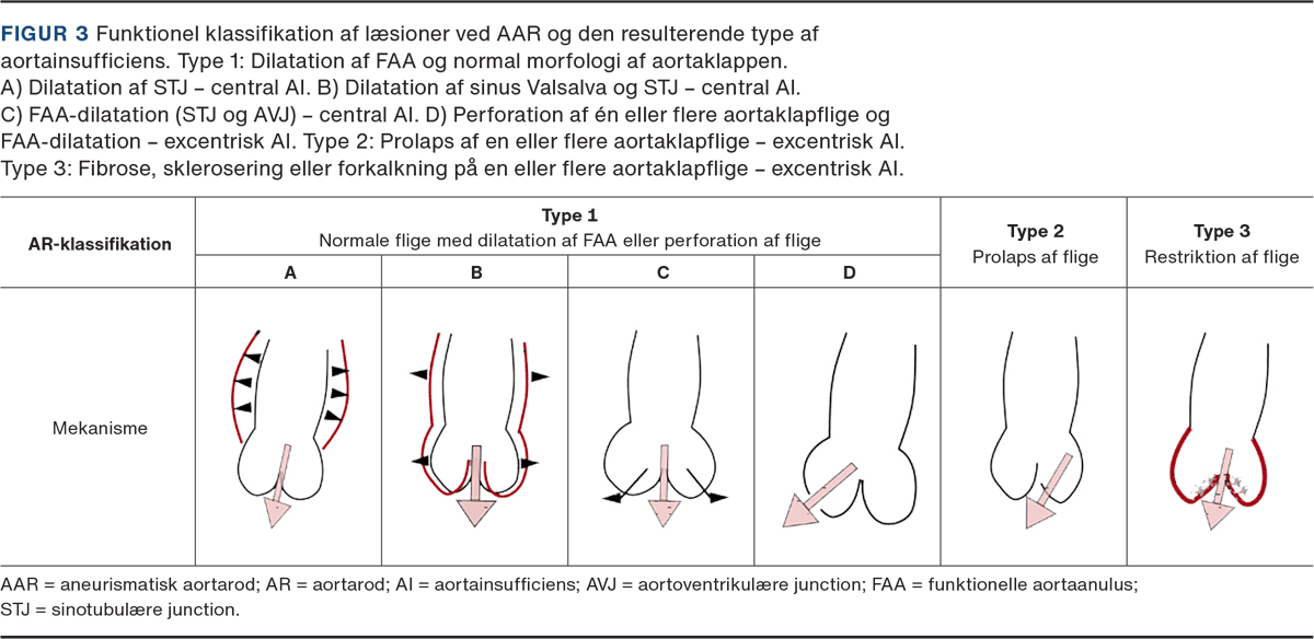 Illustration: Lytfi Krasniqi