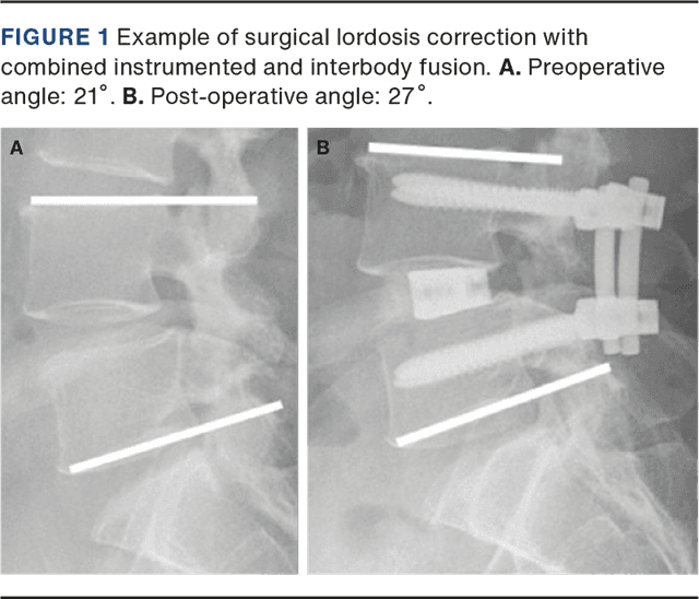 Improvement in physical function and reduced pain after instrumented ...