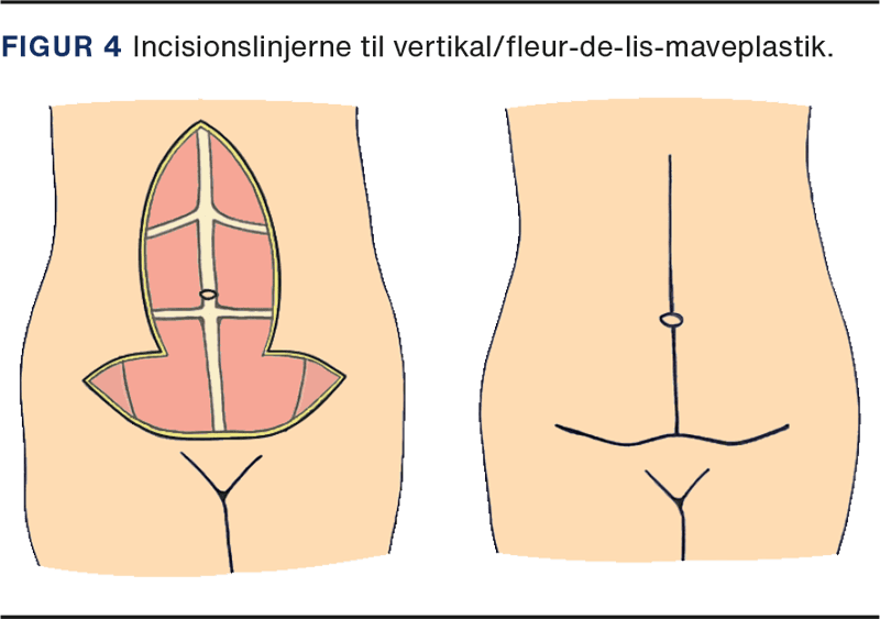 fig4