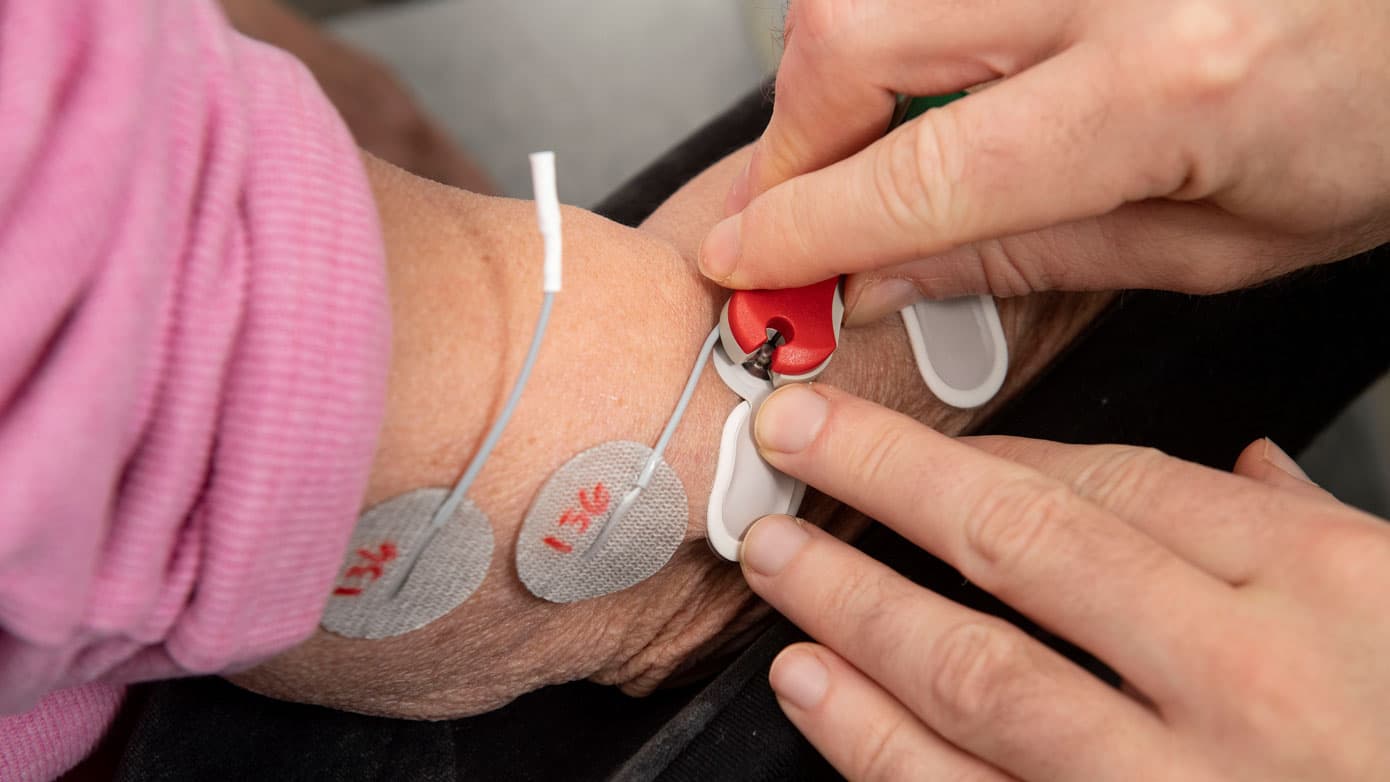 Benjamin Svejgaard monterer elektroder på patientens arm. Via de store runde elektroder stimulerer han musklerne med en let strøm. Med de andre mindre elektroder måler han armens aktivitet, når patienten træner. Foto: Lars Horn / Baghuset