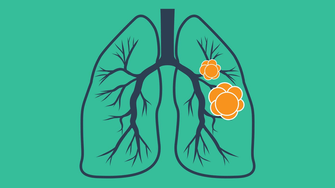 Illustration: Colourbox