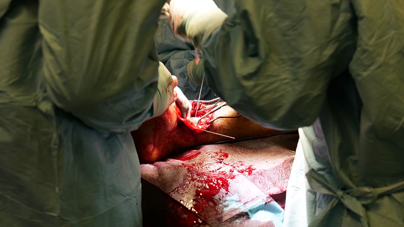 Operation med ringfiksator på Ortopædkirurgisk Afdeling, Bispebjerg Hospital. (Foto: Ugeskrift for Læger)