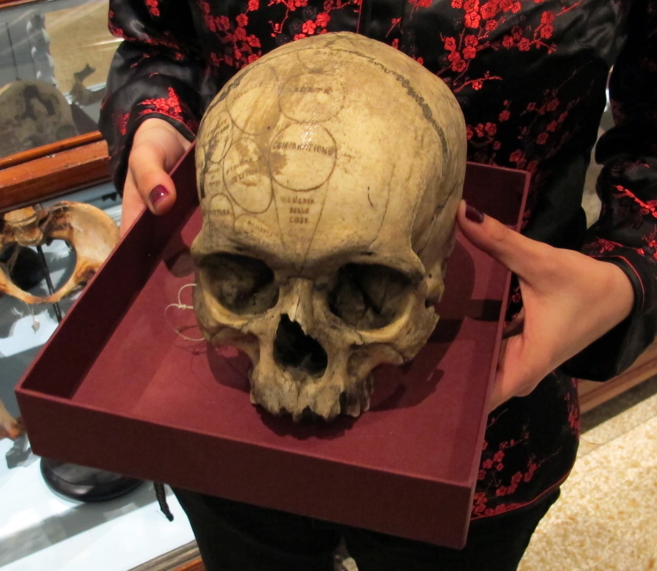 Foto: Naturhistorisk museum, biomedicinsk afdeling, Firenze.