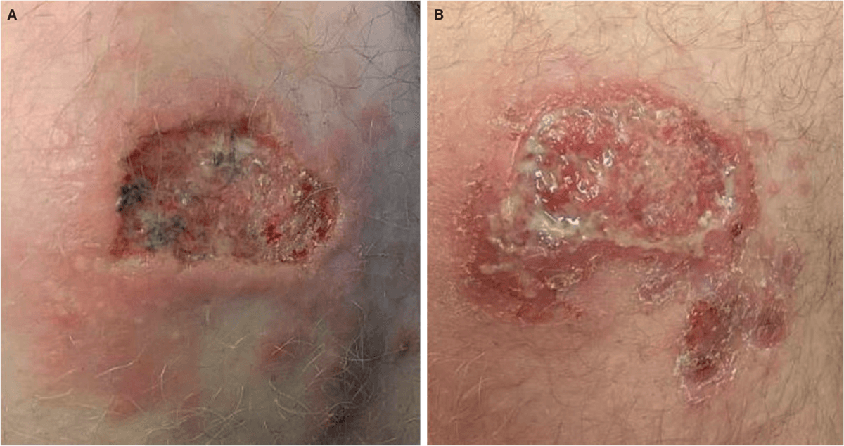 Fotos bringes med patientens tilladelse.