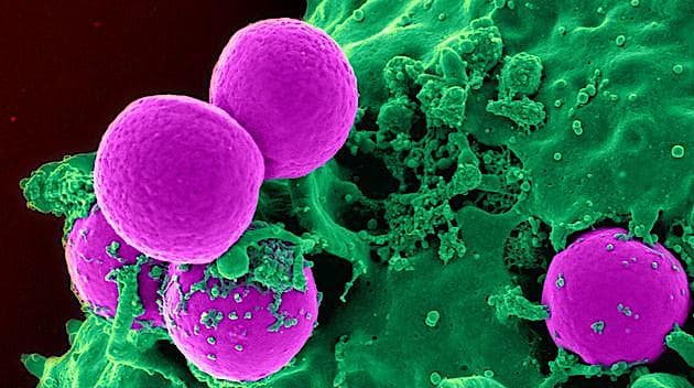 MRSA. Foto: Colourbox