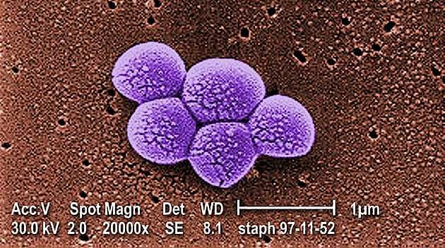 Teixobactin dræber en bred vifte af resistente bakterier, herunder MRSA (billedet). Foto: Centers for Disease Control and Prevention)