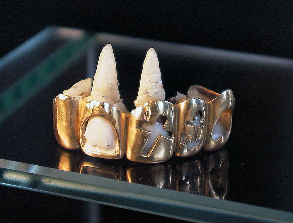 Sømandens gebis: Symbolerne for Tro, Håb og Kærlighed, udstanset i guld. Foto: Medicinsk Museion.