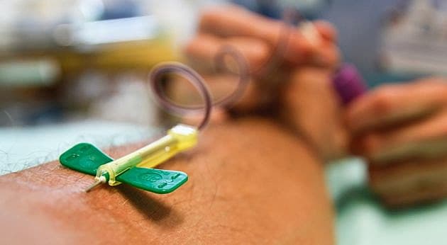 En blodprøve er tilstrækkeligt til at afsløre de mest almindelige trisomier, herunder Downs syndrom. Foto: Colourbox