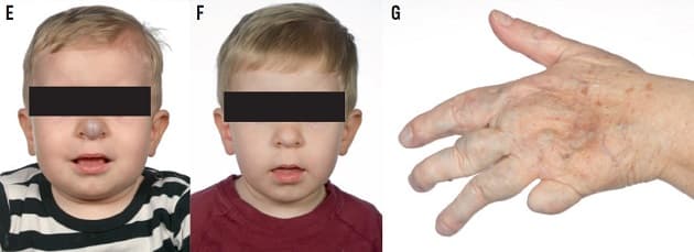 © Ugeskrift for Læger