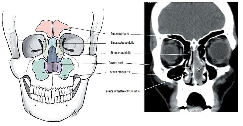 © - Illustration: Sannia Sjöstedt.