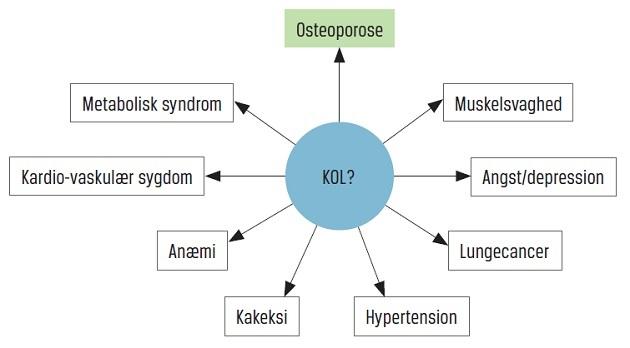 © Hyppige komorbiditeter hos patienter med kronisk obstruktiv lungesygdom (KOL).