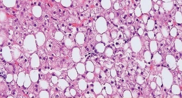 © Ugeskrift for Læger