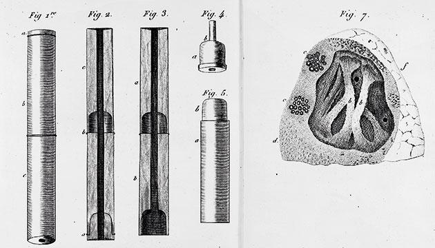 Laënnecs stetoskop  (The Wellcome Co