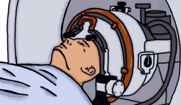 Skematisk tegning af patient-MR-skanner med påspændt fokuseret ultralydapparat. Illustration: Mikkel Schou Andersen