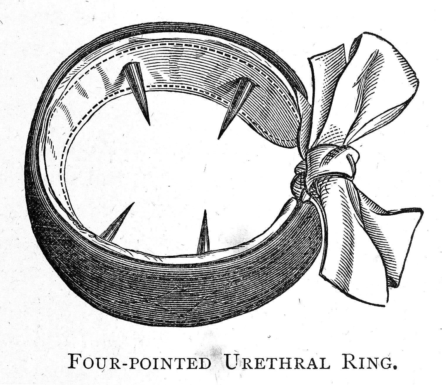 I 1880’erne kom en række perverse opfindelser på markedet, der skulle stoppe de onanistiske aktiviteter (The Wellcome Collection).