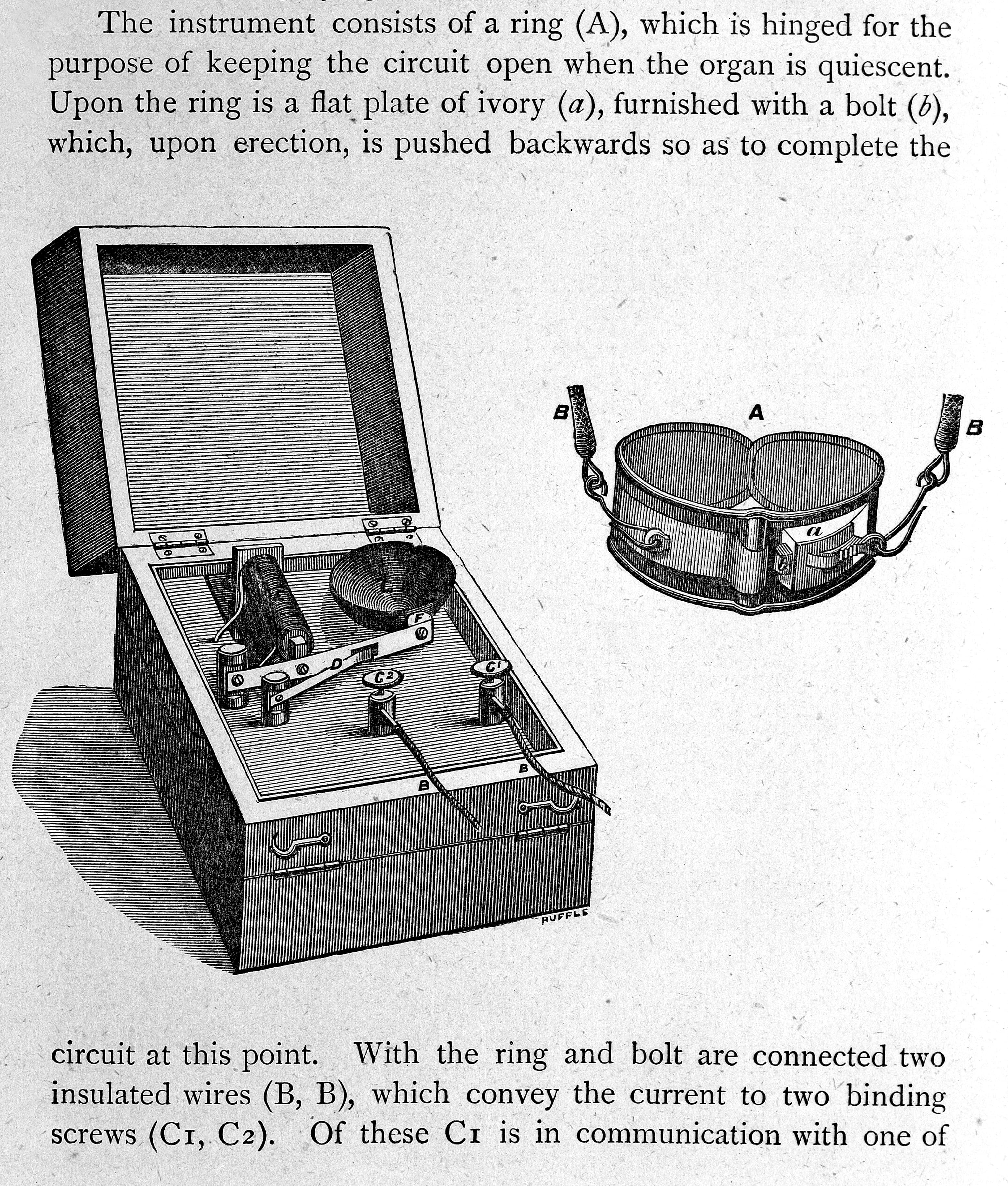 Den elektriske erektionsalarm skulle hurtigt forvandle eventuel lystfølelse til intens smerte. (The Wellcome Collection).