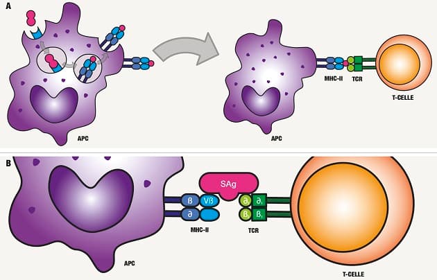 A. Antigen optages i APC, nedbrydes i lysosomet til peptidfragmenter og præsenteres på overfladen af APC. Ved binding og genkendelse af TCR, aktiveres T-cellen. B. SAg bindes direkte til MHC-II på den APC og Vβ-regionen af TCR og omgår den normale præsentationsproces.