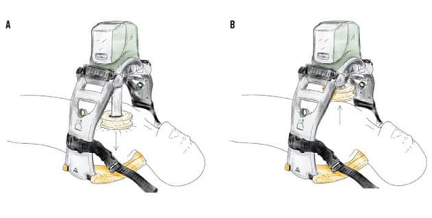 Stempelapparat. A. Stemplet komprimerer thorax. B. Stemplet retraheres, så der opnås recoil. (Illustration af Behaviour CPH).