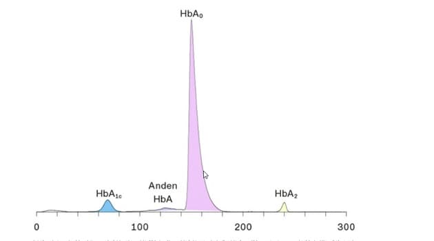 Resultatet fra en bestemmelse af den relative mængde af glykeret hæmoglobin (HbA1c) med hæmoglobinfraktionering vha. kapillærelektroferese. HbA1c-svaret angives som arealet af den lyseblå top divideret med total hæmoglobin A (summen af arealerne af den lilla, pink og gule top). HbA1c er her i normal­området.