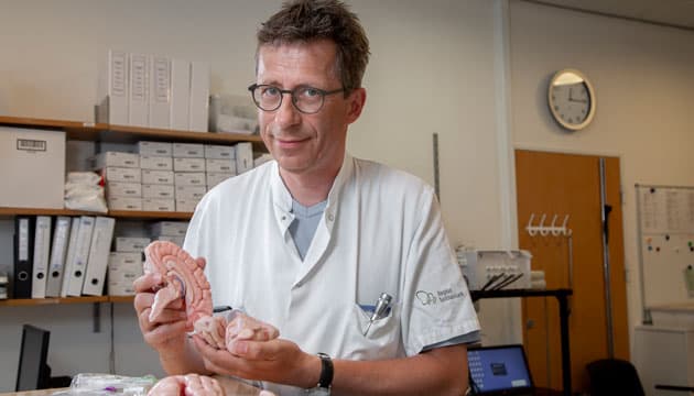 Lægerne kan ved hjernesygdomme ikke baretage en biopsi. De må vente, til folk dør, før de får deres hjerne. Og der er hjernerne så syge, at de ikke kan finde ud af, hvad der udløste sygdommen. Foto: Heidi Lundsgaard