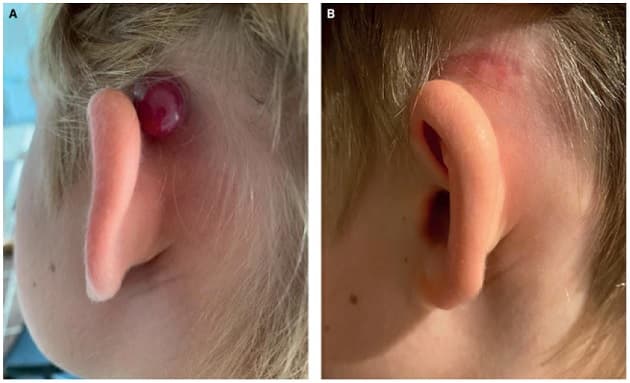 Ugeskr Læger 2021;183:V12200898