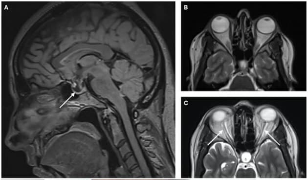 Ugeskr Læger 2021;183:V03210238