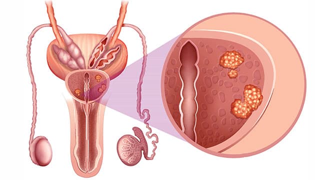 Illustration: Colourbox