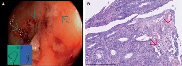 Ugeskr Læger 2021;183:V05210447