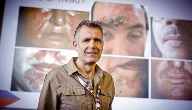 Henrik Sølvsten, speciallæge i derma-venerologi holdt kursus om dermatologi i almen praksis. Foto: Claus Boesen