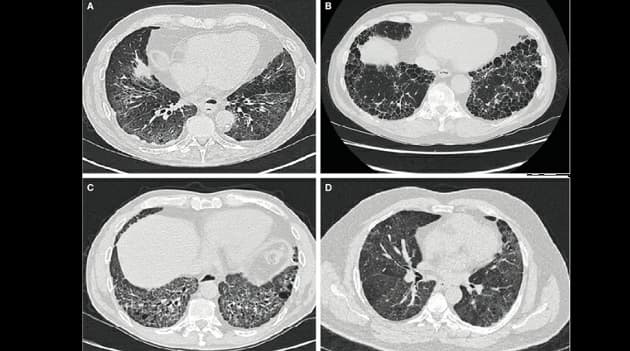 Ugeskr Læger 2021;183:V04210348
