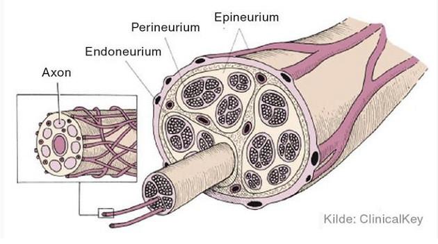 Tværsnit af perifer nerve
