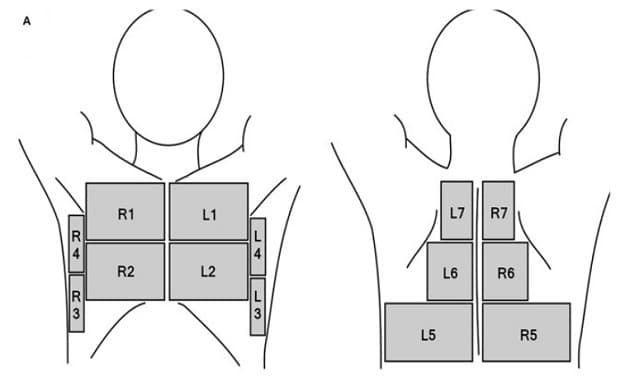 Skanningszoner. Ugeskr Læger 2022;184:V08220488