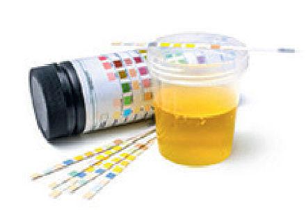 Urinstiks anbefales ikke til diagnostik af urinvejsinfektion.