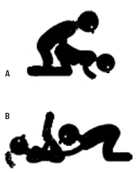 Piktogram 1 A. Coitus a tergo. B. Cunnilingus.