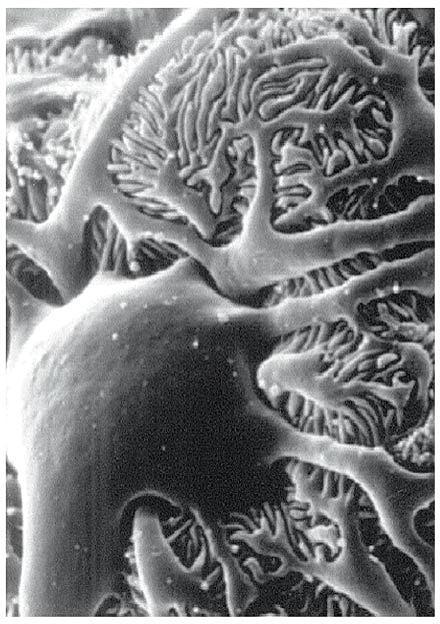 Elektronmikroskopisk billede af glomerulus.