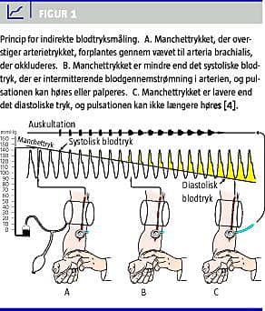 Blodtryksmåling |