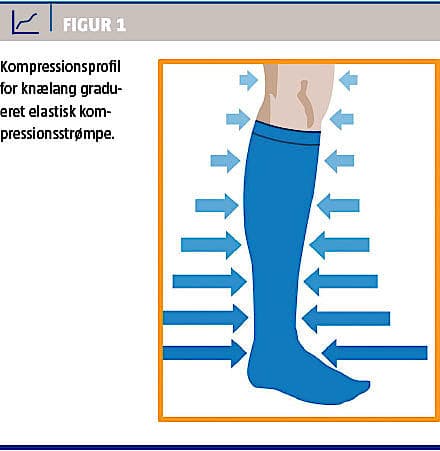 Anvendelse kompressionsstrømper | Ugeskriftet.dk
