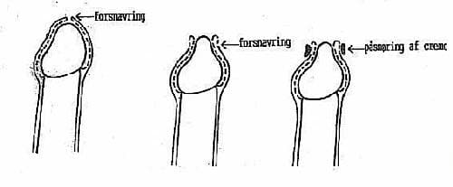 Foto: Sydvestjysk Sygehus, Esbjerg